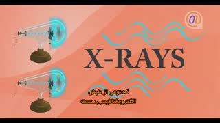 روز جهانی رادیولوژی مصادف با سالروز کشف اشعه ایکس