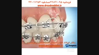 متخصص ارتودنسی