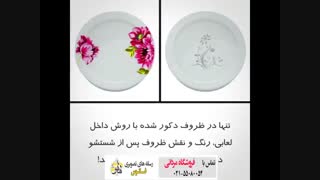 فروشگاه مردانی پوسیدگی دندان