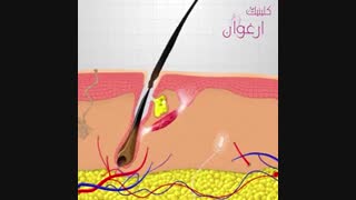 ساختمان مو ( قسمت اول )