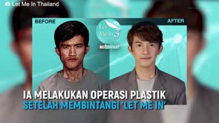 زن تایلندی ، پسر خودش را بعد از جراحی پلاستیک نشناخت !