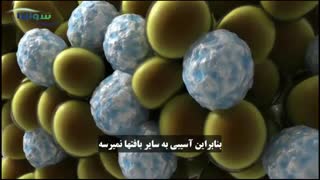 روش لاغر کردن موضعی با سرما یا کرایولیپولیز