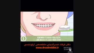 درد ارتودنسی چند روز است