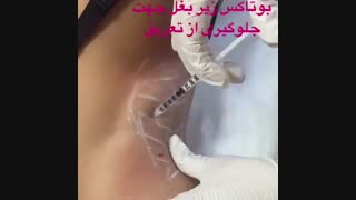 تزریق بوتاکس
