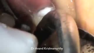 ارتودنسی و ایمپلنت