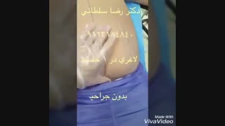 لیپوماتیک شکم