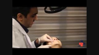 تزریق ژل در لب