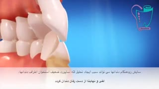 عوارض نامرتبی دندانها | سیمادنت