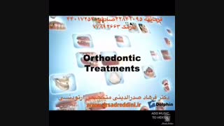 ارتودنسی بزرگسال | دکتر فرهاد صدرالدینی پوسیدگی دندان