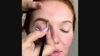 جوش و جای جوش با درمان مناسب کاملا از بین میرن و دیگه نیازی به پوشاندن اونها ندارین