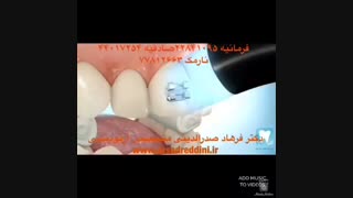 فیلم مراحل ارتودنسی دندان | دکتر فرهاد صدرالدینی جراحی زیبایی پلک