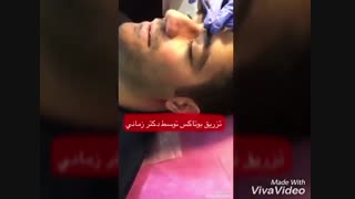 تزریق بوتاکس برای آقایان