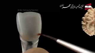اصلاح طرح لبخند | کلینیک دندانپزشکی مهر زعفرانیه