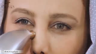 راز بهنوش بختیاری درباره لایه برداری از پوستش