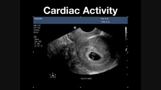 آموزش تشخیص آبستنی در گاو با سونو گرافی