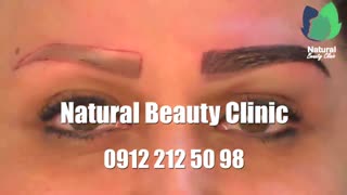 نمونه کار های کاشت ابرو در کلینیک فوق تخصصی نچرال بیوتی 