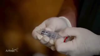 جمع آوری فراورده های خونی PRP