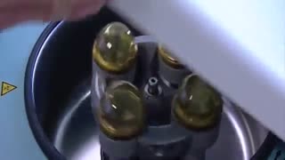 آموزش  سریع کیت جمع آوری فراورده های خونی prp