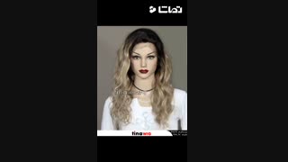 کلاه گیس زنانه جلوتور جلو فرق طبیعی (موی انسان) ترمیم مو تیناویگ tinawig.ir