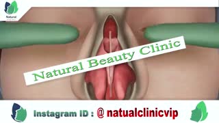 عمل بینی چگونه است ؟ حتما ببینید !!