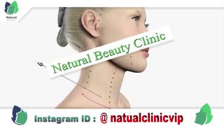 لیفت نخ صورت - نچرال بیوتی