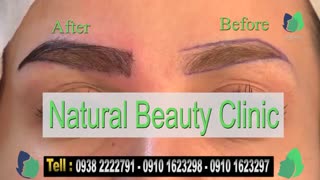 نمونه کار کاشت ابرو- قبل و بعد از کاشت!- نچرال بیوتی
