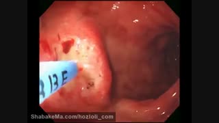 زخم اثنی عشر