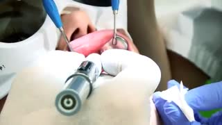 لیزر در دندان‌پزشکی