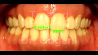 ارتودنسی محدود به نوجوانان نیست!