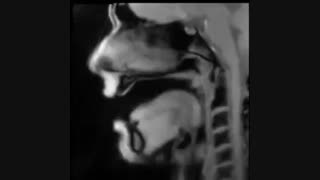 تصاویر جالب MRI در هنگام صحبت کردن