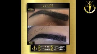 کلینیک پوست و مو ، زیبایی - آذر کلینیک