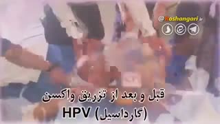 پروژه عقیم سازی مردم ایران و ماه عسل