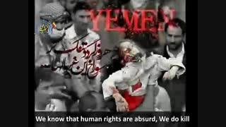 جام جهانی ما را از وقایع یمن غافل نکند