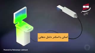 اینله و آنله دندان | کلینیک دندانپزشکی مهر زعفرانیه
