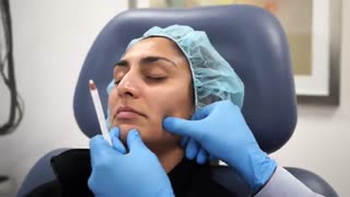 فرم دهی خط فک و صورت با تزریق بوتاکس