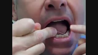 آموزش استفاده صحیح از نخ دندان