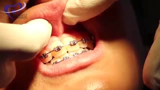 فرنوم | دکتر فاضل فیروزی تزریق ژل