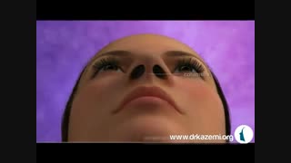 انیمیشن عمل بینی - جراحی بینی - دکتر مجید کاظمی