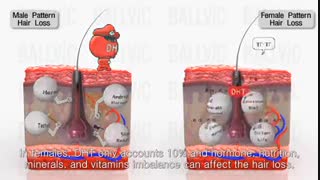 انواع ریزش مو و روش های درمان آن ها