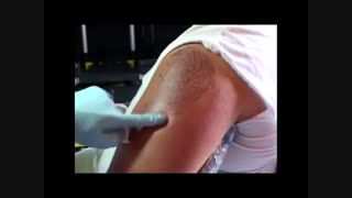 آموزش تصویری تتو