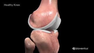 استئو آرتریت زانو ۲. مرکز تحقیقات طب درد.دکتر ابراهیم مقیمی