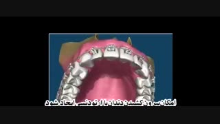 ارتودنسی دندان | کلینیک دندانپزشکی تاج