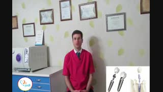 قسمت اول 8 نکته راجع به ایمپلنت