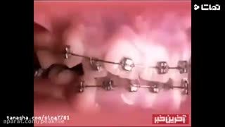 ارتودنسی دندان | کلینیک دندانپزشکی