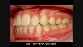 کلینیک دندانپزشکی تاج،دندانپزشکی کودکان