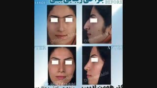 نمونه جراحی دکتر هومن ادیبی