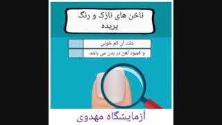 تشخیص بیماری از روی ناخن