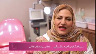 سیاه شدن ناحیه تناسلی