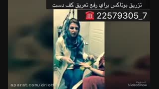 تزریق بوتاکس برای رفع تعریق کف دست لیزر صورت