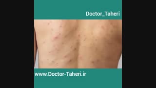 نشانه های کبد سمی